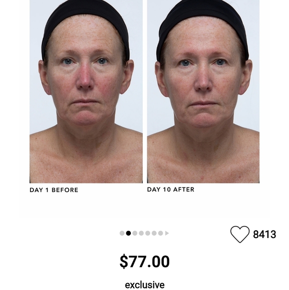 Moisturizer - Picture 2 of 4